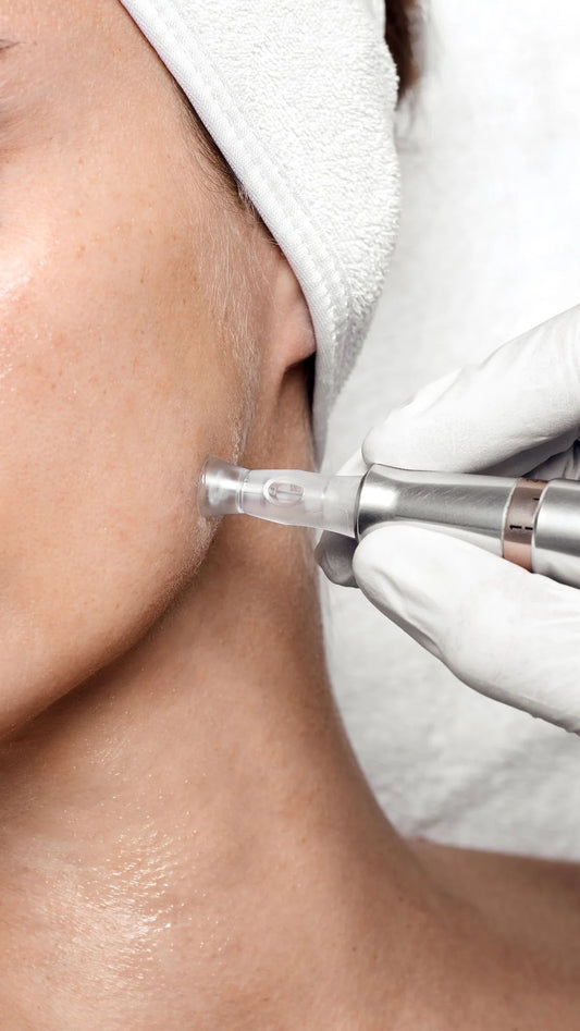 Skin by Jacqueline microneedling facial in Scottsdale, AZ promoting smooth, radiant skin with professional skincare treatment.